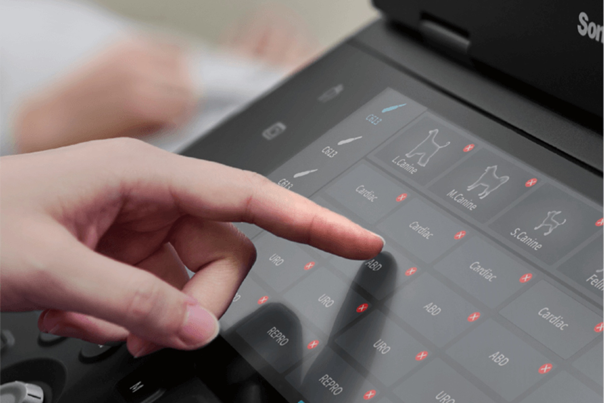 USG przenośne a aparaty stacjonarne - różnice w budowie i funkcji